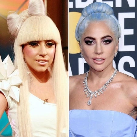 A before and after picture of Lady Gaga.
